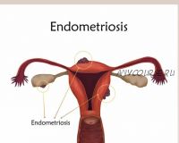 Проект 'Эндометриоз' (Юлия Шефова)