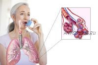 Лечение бронхиальной астмы (Александр Черепанов)