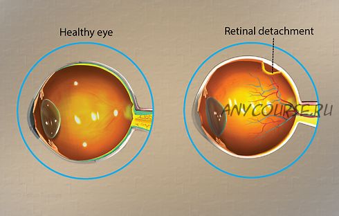 [Sigh Energy] Заживление и регенерация сетчатки. Retinal Healing and Regeneration Powerful