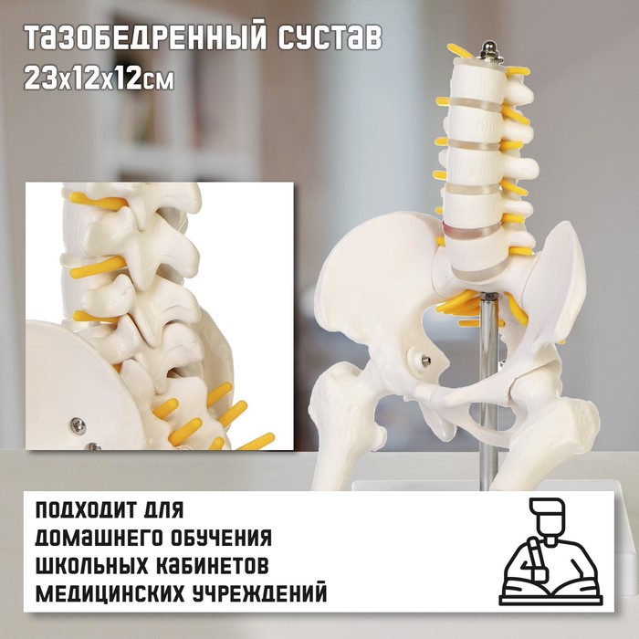 Макет "Поясничный отдел позвоночника, тазобедренный сустав" 23*12*12см